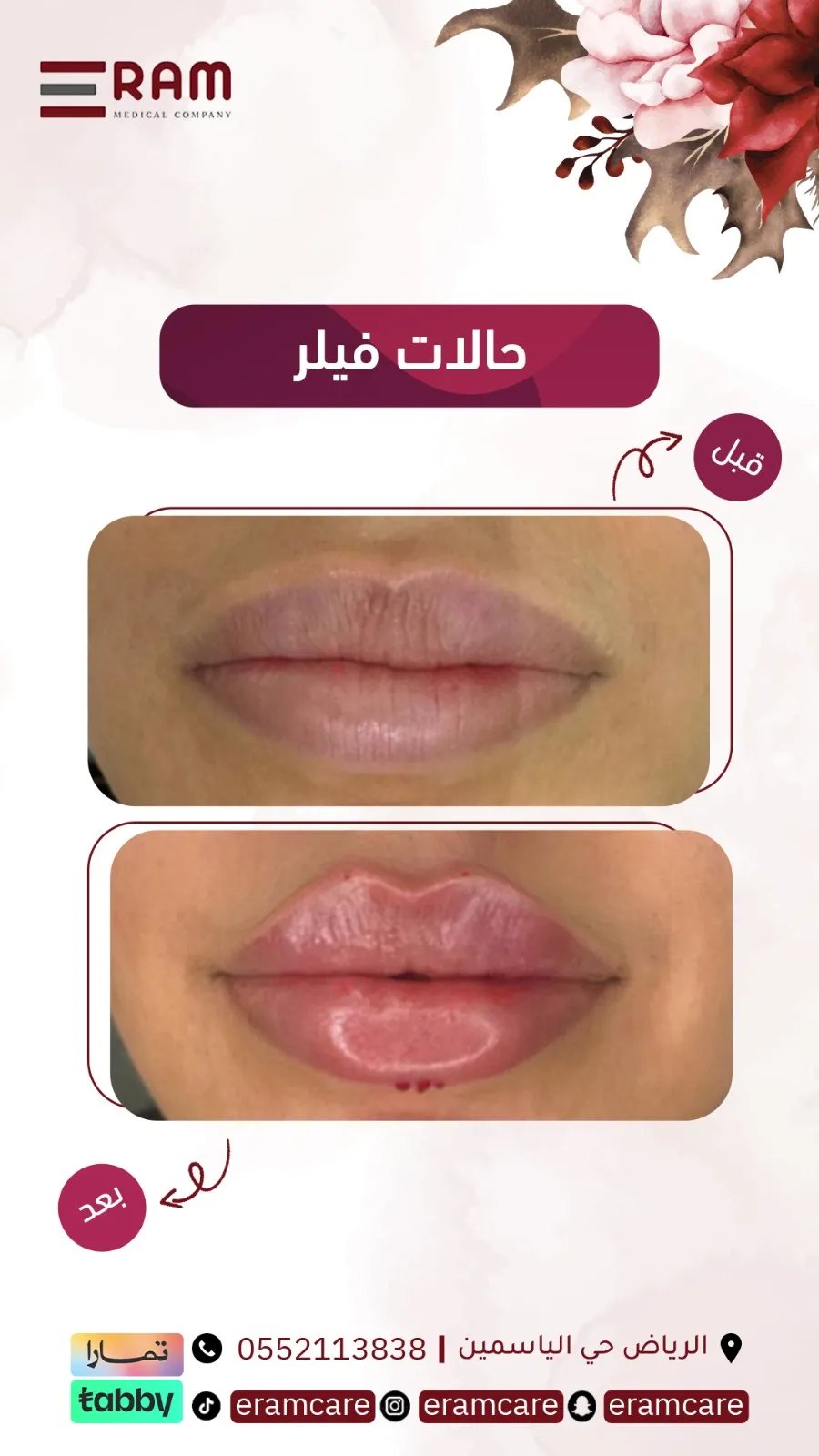 بعد تقويم - حالة 02