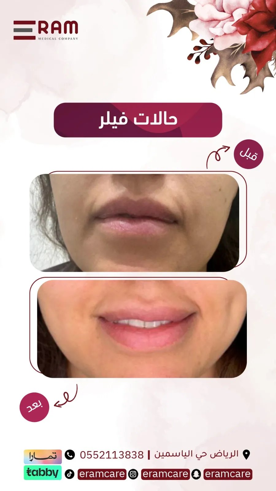 قبل تقويم - حالة 02